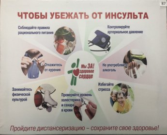 10 февраля Инсульт можно предотвратить! Простые правила для тех, кому за 60.
